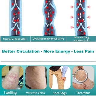 Mama Wonders Anti Embolism Compression Socks 15-20mmHg